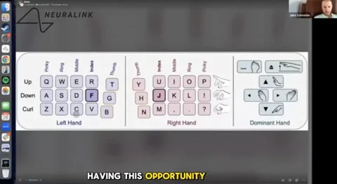 Patient mit Neuralink erreicht 141 WPM nur mit Gedanken