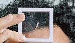 Roboter in Reisgröße navigiert Gehirn zur Tumorbekämpfung