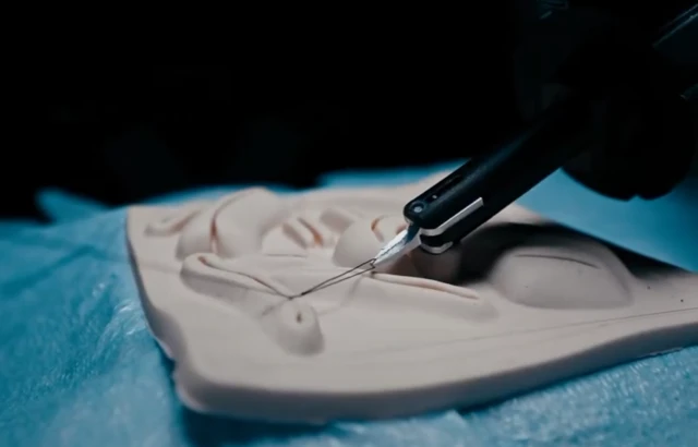 Aleph Surgery sammelt 7,5 Mio. USD von a16z für KI-Chirurgen