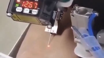 Roboter nimmt Blut ab – mit 94,3 % Erfolgsrate